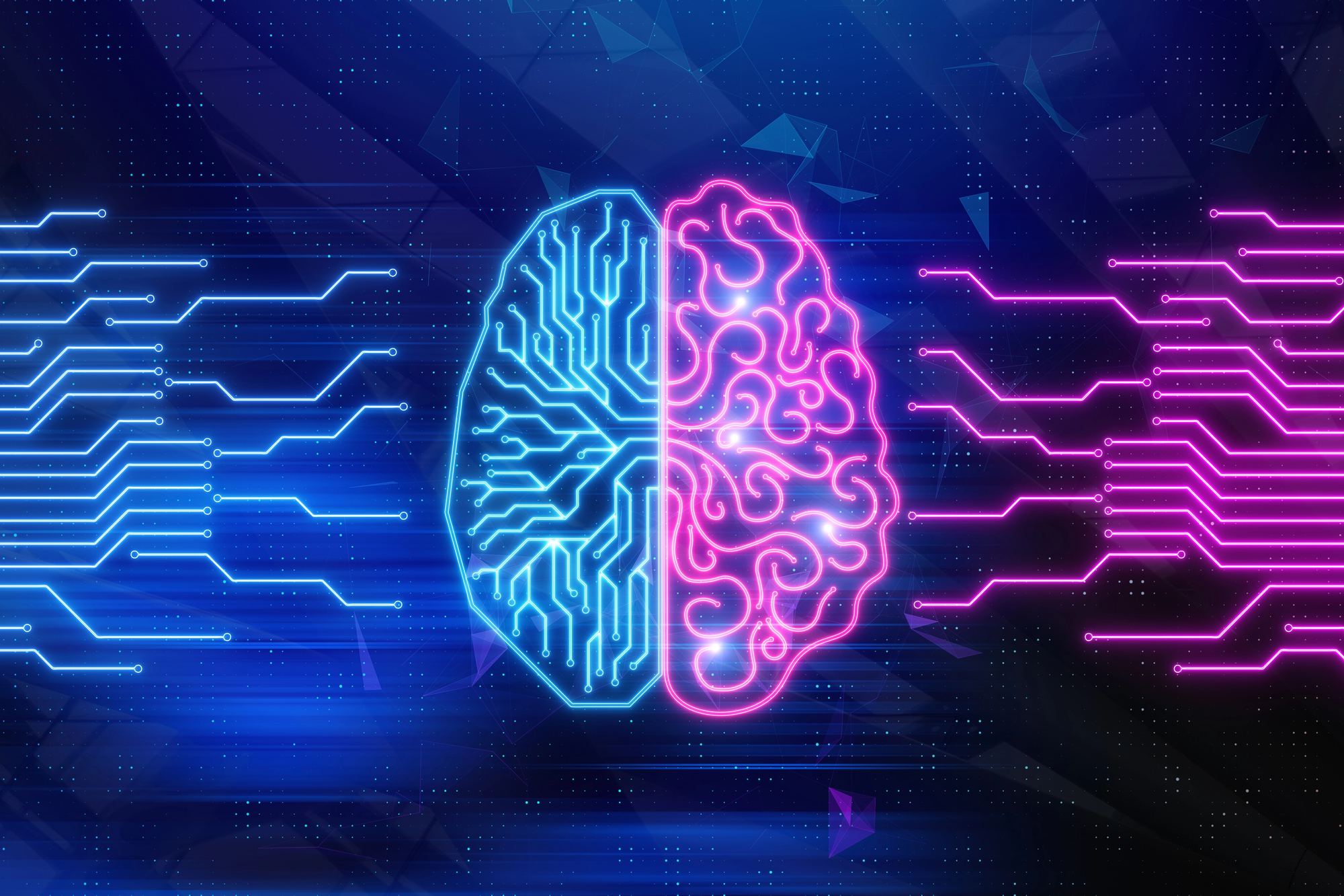 Representation of a brain