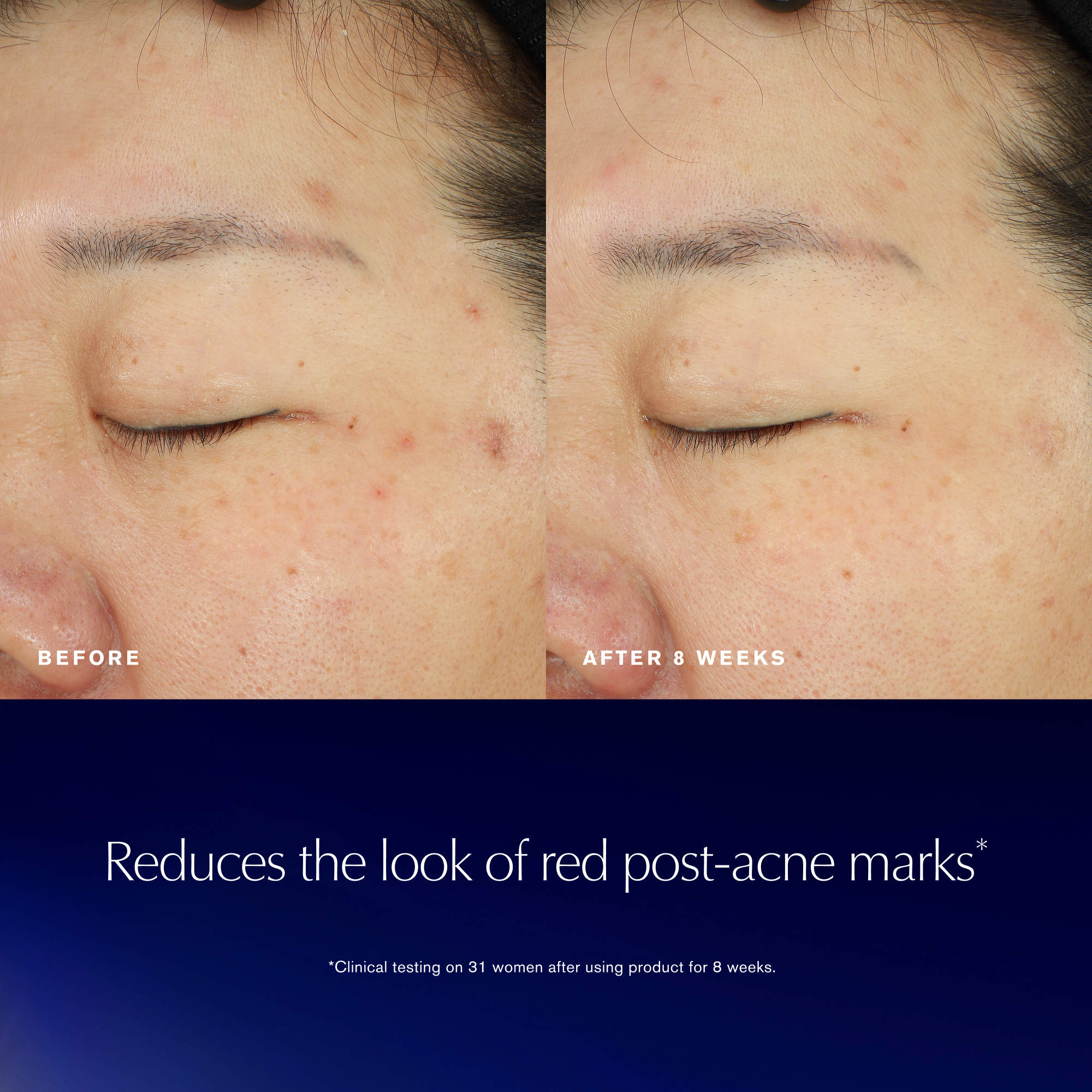 Estee Lauder Advanced Night Repair Recovery Treatment Essence
