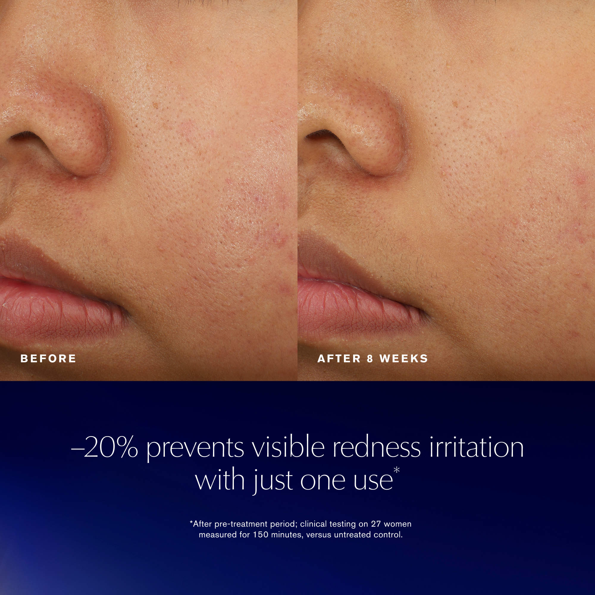 Estee Lauder Advanced Night Repair Recovery Treatment Essence