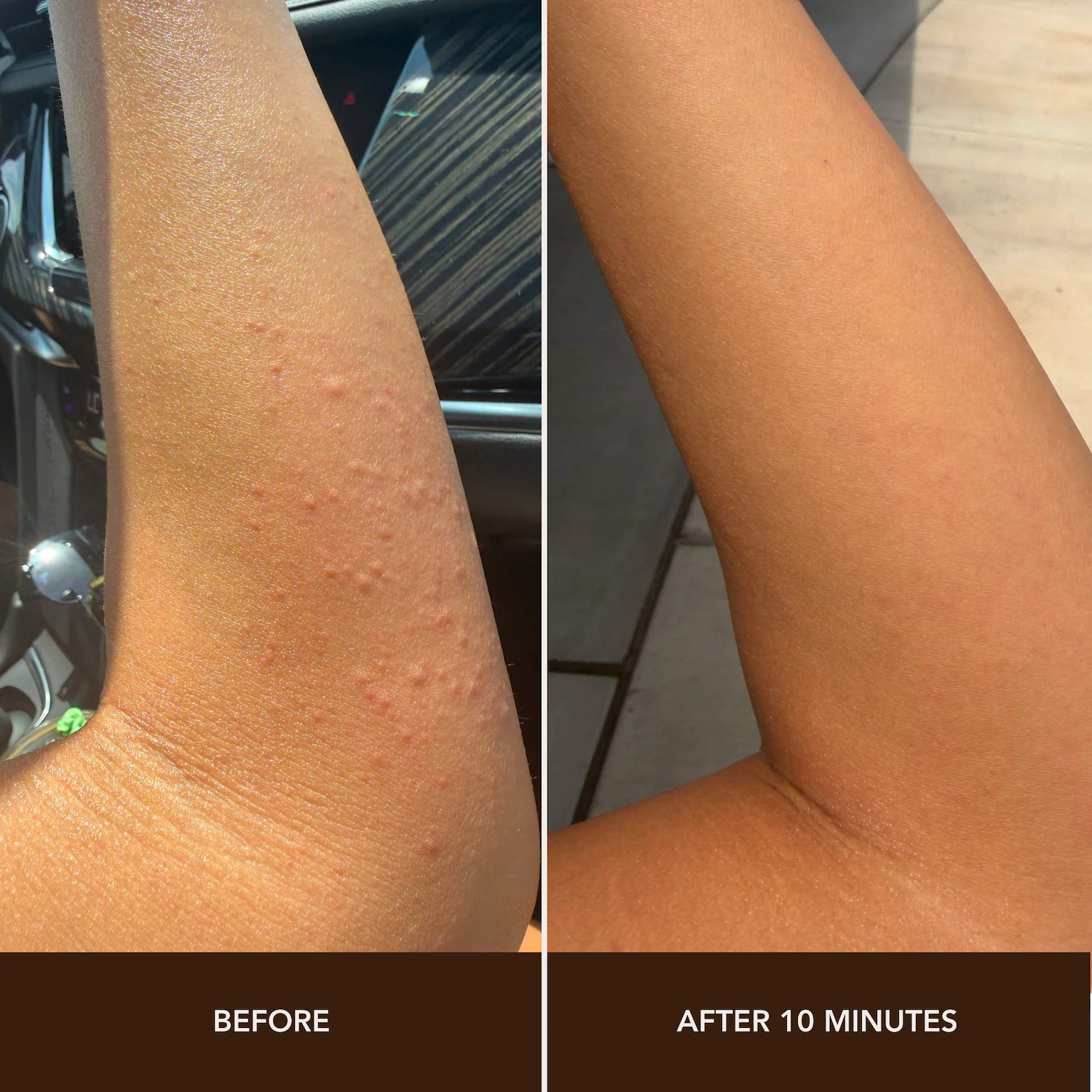 Dezi Skin Pore Choices Plant-Based Mucin Repair Mist