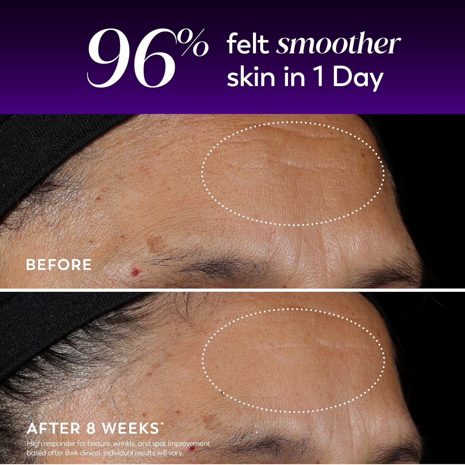 Olay Regenerist Wrinkle Correcting Treatment Serum