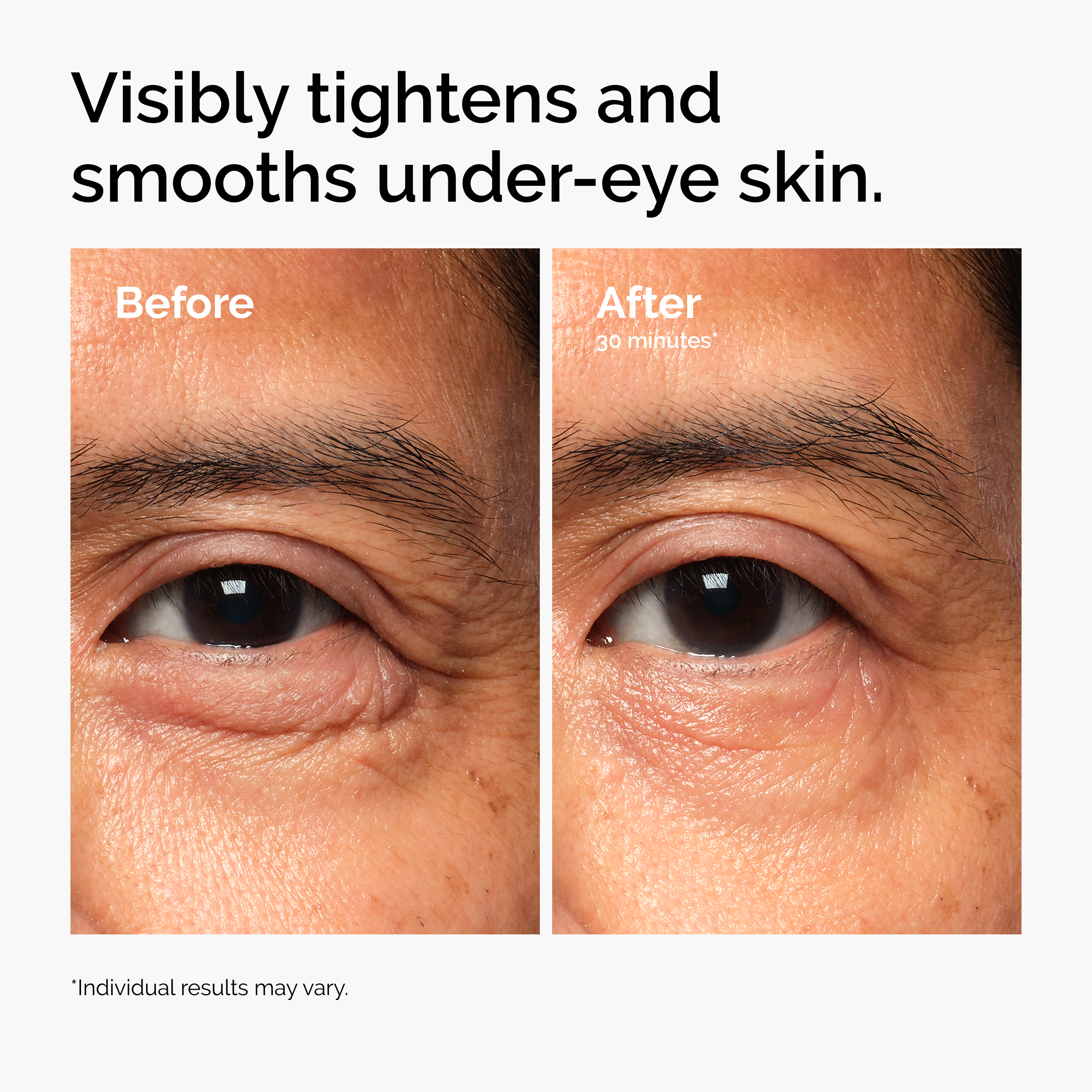 The Ordinary Lacto-PDRN* 4% + B9 Eye Cream