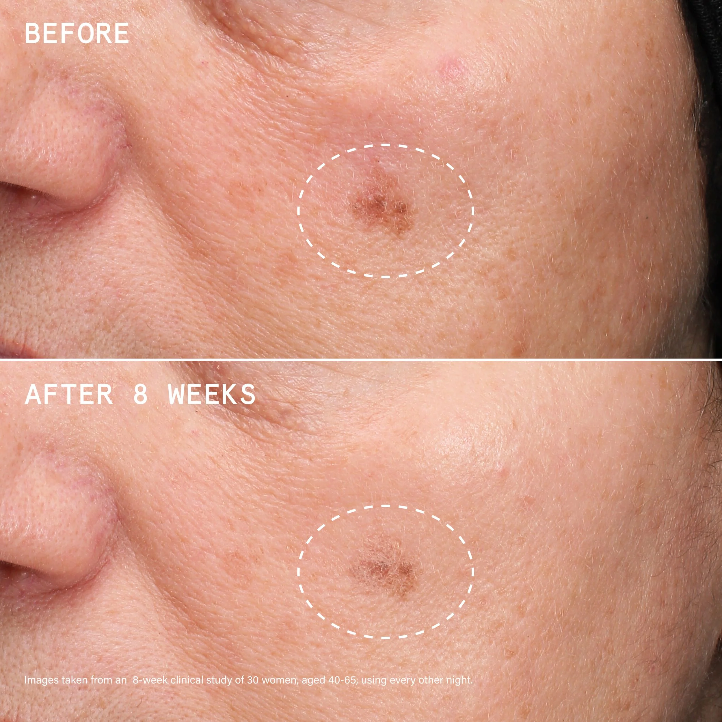 Beauty Pie Youthbomb Intense Skin Renewal Serum