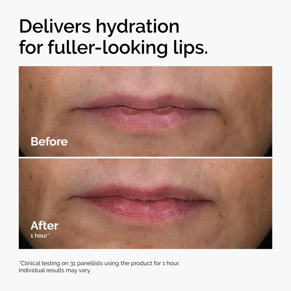 The Ordinary HA + Asiaticoside Lip Plumping Treatment